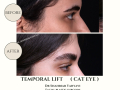 Beige Elegant Minimalist Beauty Skincare Before After Instagram Post - 32